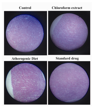 Figure 4. Histopathological sections of kidney
(Atherogenic- congestion and hyaline droplet formation)
