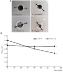 <p>Figure 5. A) Agar diffusion of LysM2 against <em>Proteus </em>(sp)<em>.</em> B) The lytic activity of LysM2 against <em>Proteus </em>(sp).</p>