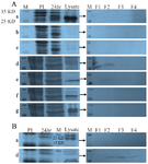 <p>Figure 4. Purification of main and control plac1 with different lysis buffers. Different lysis buffers (a-g) were used for solubilization and purification of recombinant main (A) and control plac1 (B). Composition of each buffer (a-g) is presented in table 2.</p>
<p>PI: Pre-induction, M: Protein marker, F: Fraction</p>