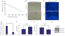 <p>Figure 1. A) The effects of green tea on LNCaP cell viability in different concentrations using MTT assay. B) Comparison of morphological changes of LNCaP before and after treatment with green tea. The experiments were performed three times (original microscope magnification, 20X, scale bar, 10 <em>&mu;m</em>). C, D) DAPI staining of LNCaP cells under treatment with green tea (sample) compared with control. The experiments were performed three times (original microscope magnification, 40X, scale bar, 10 <em>&mu;m</em>). E, F) Relative fold-changes in gene expression levels of Bax and BCL2 were shown. Data represent mean&plusmn;SD of three independent experiments. * p&lt;0.05 was considered statistically significant. G) The expression of Bax and BCL2 proteins using western blot was shown. Actin used as an internal control (TCL: Total Cell Lysate).</p>