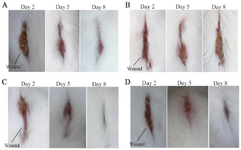 <p>Figure 3. Wound condition of mice on days 2, 5, and 8 after being injured. Taking pictures using a camera with a resolution of 20 <em>Megapixel</em>. A) Wound condition of control mice that had blood glucose levels measured before treatment was 159 <em>mg/dL</em> and after treatment 172 <em>mg/dL</em>, where the wound area on day 8 was 0.32 <em>cm<sup>2</sup></em>. B) Wound condition of control mice that had blood glucose levels measured before treatment was 177 <em>mg/dL</em> and after treatment 198 <em>mg/dL</em>, where the wound area on day 8 was 0.60 <em>cm<sup>2</sup></em>. C) The condition of the mice's wounds that were given electrical stimulation and had blood glucose levels measured before treatment was 187 <em>mg/dL</em> and after treatment 177 <em>mg/dL</em>, where the wound area on day 8 was 0.04 <em>cm<sup>2</sup></em>. D) The wound condition of mice that were given electrical stimulation and had glucose levels measured before treatment was 197 <em>mg/dL</em> and after treatment 172 <em>mg/dL</em>, where the wound area on day 8 was 0.10 <em>cm<sup>2</sup></em>.</p>