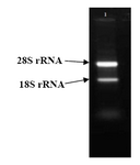 Figure 3. Total RNA electrophoresis. Upper band shows 28S rRNA and lower band shows 18SrRNA