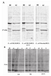 Figure 1. SDS-PAGE analysis of expression of TGRA8 in E.coli. A) Expression level of TGRA8 in three different E.coli strains. pET-28b(+)-TGRA8 construct was trans-formed into the E.coli BL21(DE3), BL21(DE3) plysS and Rosetta(DE3) cells and expression of TGRA8 was induced by addition of 0.1 mM IPTG. SDS-PAGE analysis showed the expression of an approximately 27 kDa protein in induced bacteria (AI) which was absent in uninduced bacteria (BI). The expression level of the recombinant protein seemed to be equal in the three bacterial strains. 
B) Expression level and solubility of TGRA8 in three different culture media. Recombinant Rosetta(DE3) bac-teria were cultured in LB, TB and 2XTY culture media and expression of TGRA8 was induced. SDS-PAGE analysis showed that the highest expression level was achieved in cells cultured in LB medium. The soluble and insoluble fractions of induced bacteria were analyzed on SDS-PAGE. Most of the recombinant protein was in insoluble form. However, considerable amount of the protein cultured in LB was soluble. BI) Total proteins of E.coli cells harbouring pET-28b(+)-TGRA8 before induction. AI) Total proteins after induction with 0.1 mM IPTG.