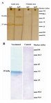 Figure 3. Western blotting analyses of purified TGRA8. A) Reactivity of purified TGRA8 with human sera. Purified TGRA8 was analyzed on the SDS-PAGE, transferred onto the nitrocellulose membrane and probed with the acute and chronic pooled sera from pregnant women. The purified antigen strongly reacted with IgG and IgM antibodies in acute sera, while no specific band can be observed on the blot probed with chronic sera,. The protein band of about 54 kDa was probably attributed to the dimmer of TGRA8. B) Evaluation of immunogenicity of TGRA8. One Rabbit was injected intramuscularly with 100 μg of TGRA8 three times with two weeks intervals. Two weeks after the last injection rabbit serum sample was obtained. Tachyzoites of T.gondii RH strain (5×106 tachyzoites) were analyzed by SDS-PAGE, transferred onto nitrocellulose membrane and probed with the serum samples from the TGRA8-immunized and adjuvant-injected rabbits. The serum from the TGRA8-immunized rabbit recognized a single protein band of 35 kDa, the expected size of the native GRA8 antigen, while the serum from the adjuvant-injected rabbit failed to react with any specific protein of RH tachyzoites