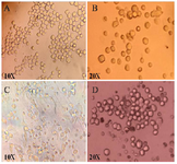 <p>Figure 1. A) SP2/0 cells, B) Immunized mice splenic cells, C) Hybridomas on first day after fusion and D) hybridoma colonies on 15 days after fusion.</p>
