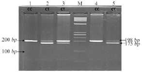 <p>Figure 1. Restriction fragment length polymorphism result of MTHFR rs1801133 (C&gt;T).</p>
