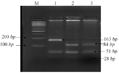 <p>Figure 2. Restriction fragment length polymorphism result of MTHFR rs1801131 (A&gt;C).</p>
