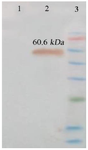 <p>Figure 9. Identification of protein expression (IpaD-StxB-TolC) using western blot analysis. The anti-His antibody detected the expression of a chimeric protein (60.6 <em>kDa</em>). Lane 1: Control (Bovine Serum Albumin, BSA). Lane 2: Chimeric protein. Lane 3: Protein weight marker (prestained protein ladder, 10- 170 <em>kDa</em>).</p>
