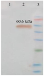 <p>Figure 9. Identification of protein expression (IpaD-StxB-TolC) using western blot analysis. The anti-His antibody detected the expression of a chimeric protein (60.6 <em>kDa</em>). Lane 1: Control (Bovine Serum Albumin, BSA). Lane 2: Chimeric protein. Lane 3: Protein weight marker (prestained protein ladder, 10- 170 <em>kDa</em>).</p>
