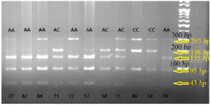 <p>Figure 1. Photograph of RFLP method of&nbsp;<em>PTCH1</em>&nbsp;(rs10512248) polymorphism: after digestion of PCR products with the restriction enzyme Eco571 for three genotypes of NSCL/P cases, one specific band of 155 <em>bp</em> was indicated in AA genotype, two specific bands of 198 and 155 <em>bp</em> were revealed in the AC genotype, and one specific band of 198 <em>bp</em> was indicated in CC genotype.</p>
