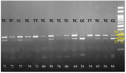 <p>Figure 2. Photograph of RFLP method of&nbsp;<em>RAD54B </em>(rs12681366) polymorphism. After digestion of PCR products with the restriction enzyme NlaIII for three genotypes of NSCL/P cases, one specific band of 285 <em>bp</em> was indicated in TT genotype, two specific bands of 285 and 234 <em>bp</em> were revealed in the TC genotype, and one specific band of 234 <em>bp</em> was indicated in CC genotype.</p>
