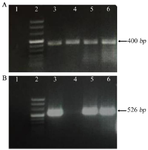 <p>Figure 3. Gel electrophoresis results. A) The quality of the synthesized cDNA was evaluated by gel electrophoresis using TBP specific primers. Relative expression of <em>TBP</em> gene in the different cell lines by quantitative PCR. Positive samples have the desired 400 <em>bp</em> band. Negative sample (DDW) have no band. 1) No template control (NTC, DDW), 2) DNA size marker, 3) Raji, 4) Normal PBMC, 5) MCF-7, and 6) A431. B) Relative expression of TAZ mRNA in the different cell lines by quantitative PCR. Positive samples have the desired 526 <em>bp</em> band, PBMC or negative samples (DDW) have no band. Arrangement of loaded cDNAs: 1) No template control (NTC) (DDW), 2) DNA size marker, 3) Raji, 4) Normal PBMC, 5) MCF-1 6-A431.</p>