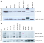 <p>Figure 4. Investigation of TAZ expression in a number of cell lines via Western blot analysis. A) using commercial anti-TAZ pAb and Anti-&beta;-actin mAb. Arrangement of loaded lysates: 1) Raji 2) A431 3) MCF-7 4) HFFF-PI6, 5) MDA-MB231 6) Size Marker 7) RPMI8226. B) Anti-TAZ mAb and Anti-&beta;-actin mAb. All cells ex-pressed TAZ protein except PBMC. Arrangement of loaded lysates: 1) Raji 2) A431 3) MCF-7 4) HFFF-PI6, 5) MDA-MB231 6) RPMI8226 7) Size Marker 8, 9, 10) Normal PBMC.</p>