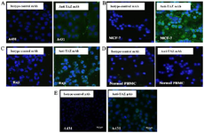 <p>Figure 6. Immunocytochemistry (ICC) assay on A) A431 B) MCF-7 C) Raji cell lines, D) normal PBMCs and E) pAb anti TAZ on A431 cell line. Mouse monoclonal anti-TAZ antibody was used as a primary antibody and FITC-conjugated sheep anti-mouse antibody as a secondary antibody (Green). DAPI was used for counterstaining the nucleus (Blue).</p>