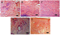 <p>Figure 8. Photomicrograph of histopathological section of wound tissue of rats (stained with Haematoxylin and Eosin, 40x magnification). Inflammatory cells, collagen fibers with scar tissue, fibroblast cells, and blood vessels were seen in Group I (Figure 8A). There was less cellular necrosis and more collagen fibers and blood vessels in Group IV (Figure 8B). Group V showed prominently increased fibroblast cells, blood vessels, and well-organized collagen fibers as compared to the control (Figure 8C). Necrotic cells with fewer collagen fibers and blood arteries were seen in Group II (Figure 8D). More fibroblast cells with collagen fibers, blood vessels, and fewer inflammatory cells were seen in Group III, indicating complete tissue regeneration (Figure 8E). Scale bar: 20 <em>&mu;m</em> in all the figures.</p>