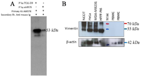 <p>Figure 1. A) The results of immunoprecipitation and Western blot (IP-WB) analysis. The produced monoclonal antibody 7C11-D9 (Lane 1) and commercial anti-vimentin antibody (RV-202, Abcam) (Lane 2) were used for precipitation of vimentin in U373 (Lane 2, 3) as vimentin positive. Commercial anti-vimentin antibody and HRP-conjugated sheep anti-mouse were used as primary and secondary antibodies, respectively.) A band of ~53 <em>kDa</em> is represented the 7C11-D9 mediated immunoprecipitated vimentin protein detection by anti-vimentin antibody in U373 cells. B) Western blot analyses of a HRP-conjugated anti-vimentin antibody (7C11-D9) on cell lysates from different cancer cell lines and PBMC from normal healthy individuals. NCCIT (RRID: CVCL_1451), HeLa (RRID: CVCL_ 0030), MDA-MB-231 (RRID: CVCL_0062), HFFF-PI 6 (RRID: CVCL_9V94), M.W. (Molecular weight marker). Similar filter membrane was probed with mouse monoclonal anti-beta actin antibody as primary antibody as internal loading control. HRP-con-jugated sheep anti-mouse Ig was used as secondary.</p>