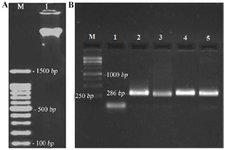 <p>Figure 3. Molecular identification of MRSA. A) Electrophoresis results of MRSA genome extraction, Lane M: 100 <em>bp</em> molecular size marker. Lane 1: Genomic DNA extracted. B) PCR products of <em>mecA</em> gene, Lane M: 1 <em>kb</em> molecular size marker. Lane 1: Negative Control for <em>mecA</em> (MSSA). Lane 2: Positive Control for <em>mecA</em> (286 <em>bp</em>). Lane 3-5: positive isolate for <em>mecA</em> gene.</p>