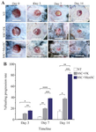 <p>Figure 2. Gross evaluation of wound healing progression. A) Macro photographs of wounds from one selected mouse in each group in three time points. B) The percent of wound healing progression during three time points (p-values less than 0.05, 0.01, 0.001, and 0.0001 were shown with *, **, ***, and ****, respectively.</p>
