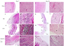 <p>Figure 2. Histopathological evaluation of cardiac function at days 7 &amp; 28 post MenSCs administration; A &amp; B) Section from sham group shows normal architecture at day 7, C) In MI group, the ischemic region is mainly occupied by granulation tissue (arrow) at day 7, D) Higher magnification of a slide belonged to MI group shows a greater cellular granulation tissue (rectangle) and cardiomyonecrosis (arrow), E) In CM group, the main&nbsp; structure is granulation tissue (circle) at day 7, F) Higher magnification of pervious slide, notes to high cellularity within granulation tissue (rectangle), and necrotic cardiomyocytes (arrow), G) In MenSCs+ CM group, many preserved cardiomyocytes (circle) could be seen in the ischemic area at day 7, H) Higher magnification of pervious slide, note to inflammatory cells infiltration (arrow) among preserved muscle fibers (rectangle), I &amp; J) Normal histology of section belonged to sham group at day 28, K) Note to myocardial scar tissue bulged (arrow) at day 28, L) Higher magnification of pervious image, notes to cartilaginous metaplasia (star) in the center of scar tissue, M) Note to mature granulation tissue (green arrow) and cartilaginous metaplasia (black arrow) in CM group at day 28, N) Note to cartilaginous metaplasia (star) with higher magnification in CM group O) In MenSCs+CM group, the infarct area is limited and scattered cardiomyocyte&rsquo;s islets (arrow) are preserved at day 28 P) Higher magnification of pervious photomicrograph with preserved muscle fibers (arrow) (H &amp; E, Bar=A, C, E, G, I, K, M,&nbsp; and O: 500 <em>&mu;m</em>; B, D, F, H, J, L, N and P: 50 <em>&mu;m</em>).</p>
