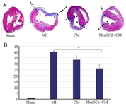 <p>Figure 3. A) Evaluation of myocardial infarction size at day 28 post-MI, representative transversal sections of heart and Masson&rsquo;s trichrome staining for infarct size measurement. Scar tissue is co-lored in blue and healthy myocardium in red. Scale bar=1.5 <em>mm,</em> B) Percentage of circumferential infarct size (MI size), *p˂0.05.</p>
