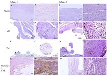 <p>Figure 5. IHC staining of type I and II collagen in the myocardium at day 28 (A &amp; B) No expression of Col I, (C &amp; D) In MI group, no expression of Col I is detected in cartilaginous metaplastic site, (E) Note to limited expression of this marker by some chondrocytes in metaplastic site in CM group (arrow), (F) Higher magnification of pervious slide (arrow), (G &amp; H) The expression of Col I in MenSCs+CM group occurs in scar tissue, (I &amp; J) Sham group, no expression of Col II, (K) Note to expression of Col II by chondrocytes in cartilaginous metaplastic site in cases with no-treated MI (rectangle), (L) Higher magnification of pervious slide (arrow), (M) The positive expression of Col II was detectable in metaplastic region of the case that received only CM (rectangle), (N) Higher magnification of pervious slide (arrow), (O &amp; P) There is no detectable expression of Col II in scar tissue of MenSCs+CM group (IHC, Scale bar = A, C, E, G, I, K, M and O: 200 <em>&mu;m</em>; B, D, F, H, J, L, N and P: 50 <em>&mu;m</em>).<sup>*</sup>p&lt;0.05, p&lt;0.01, and <sup>#</sup>p&lt;0.001.</p>
