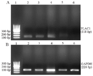 <p>Figure 1. Agarose gel electrophoresis of real-time PCR products of PLAC1 (A) and GAPDH (B).</p>
<p>Lanes 1: marker 100 <em>bp</em>, 2: AML12-BM, 3: AML7-PB, 4: ALL1-BM, 5: ALL23-PB, 6: Normal 4.</p>
