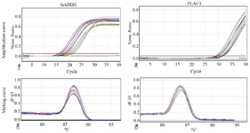 <p>Figure 2<em>. </em>The real time PCR amplification curve and melting curve of <em>PLAC1</em> and <em>GAPDH.</em></p>
