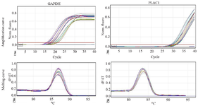 <p>Figure 2<em>. </em>The real time PCR amplification curve and melting curve of <em>PLAC1</em> and <em>GAPDH.</em></p>
