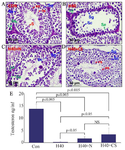 <p>Figure 2. Attenuation of heat-stress-induced spermatogenesis complications by GP extract in mice. A) Normal spermatogenesis in the seminiferous tubules in the testes of the control group (CON). B) Spermatogenesis in seminiferous tubules disruption in heat stress-induced mice at 40<em>&deg;C</em> (H40). C) Extraction of natural products from plant recovery spermatogenesis (H40+N). D) Extraction of biomass products from cell suspension culture recovered spermatogenesis (H40+CS). E)&nbsp; The extraction of natural products from plants and biomass products from cell suspension cultures recovers blood testo-sterone levels. Le: Leydig cells, Se: Sertoli cells, Sg: Spermatogonia, Sc: Spermatocytes, rs: round spermatids, es: elongating spermatids, S: Spermatozoa</p>