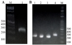 <p>Figure 2. Analysis of RT-PCR product using 1% agarose gel electrophoresis. A) RT-PCR reaction with total RNA extraction from the patients' respiratory samples. Lane 1: RT-PCR product using primers F3/B3. B) PCR reaction with TA-E plasmid. Lane 1-4: PCR product using primers F3/B3, Lane M: 100 <em>bp</em> DNA leader.</p>