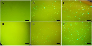 <p>Figure 1. GFP expression was used to evaluate the efficiency of plasmid transfection. MCF7 cells showed GFP expression 24 <em>hr</em> (B) and 48 <em>hr</em> (C) after transfection. MCF7-ADR cells showed GFP overexpression 24 <em>hr</em> (E) and 48 <em>hr</em> (F) after transfection. Figure A and D illustrate the control un-transfected MCF7 and MCF7-ADR cells. Scale bar: 20 <em>&micro;M</em>.</p>