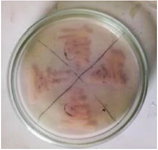 <p>Figure 2. L-asparaginase secondary screening of the isolate plate.</p>
