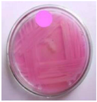 <p>Figure 3. 19<sup>th</sup> Isolate were selected on secondary screening medium for L-Asparaginase activity.</p>
