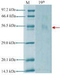 <p>Figure 5. Electrophoresis with SDS polyacrylamide gel 19<sup>th</sup> culture.</p>