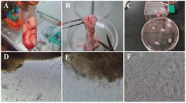 <p>Figure 2. Isolation of WJ-MSCs by explant method. A) The whole umbilical cord, B) The cross-section of the umbilical cord and the umbilical cord blood vessels, C) Wharton's jelly cut into 3&ndash;4 <em>mm</em> explants. Representative phase-contrast images of the WJ-MSCs; D) The morphology of primary cells that migrated from explant tissue day 7, E) The morphology of cells after 10 days, F) and after 14 days, WJ-MSCs were grown from the explants.</p>