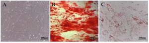 <p>Figure 3. Characterization of Wharton's jelly-derived mesenchymal stem cells (WJ-MSCs) (A) Spindle-shaped, fibroblastic-like mesenchymal stem cells derived from human umbilical cord WJ-MSCs (B) Osteogenesis differentiation assay with alizarin stain revealed the formation of calcium oxalates in differentiated MSCs. (C) Oil-red O intracellular staining for representation of adipogenic differentiation of WJ-MSCs.</p>