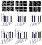 <p>Figure 1. Cell migration assays in Colorectal cancer cells under normoxic and hypoxic conditions. A) Scratch assays were performed on HT29, HCT116, and SW480 cells to assess migration under normoxic conditions. B) Scratch assays were performed on HT29, HCT116, and SW480 cells to assess migration under hypoxic conditions. Both panels (A) and (B), cells were either infected with HSV-HMGB1 to induce <em>HMGB1</em> overexpression or with the control virus HSV-ble. The gap filling was examined at 24 <em>hr</em> post-scratch. No significant migration was observed in HSV-HMGB1-infected CRC cells under any tested conditions, including hypoxic environments. Similarly, no migration was detected in the control cells infected with HSV-ble under both normoxic and hypoxic conditions. Notably, migration was observed in uninfected CRC cells under hypoxic conditions, suggesting that hypoxia alone can induce migration in all three cell lines. The experiments were performed with six replicate, and representative images are shown. Error bars represent standard deviation. Image analysis was conducted using Image J software. *p&lt;0.05, **p&lt;0.01.</p>