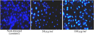 <p>Figure 2. DAPI staining was performed on MCF-7 cells exposed to the ethyl acetate extract of <em>T. persicum</em> at concentrations of 50 and 100 <em>&mu;g/ml</em>. MCF-7 cells treated with the extract showed apoptotic changes (condensed and fragmented nuclei). No such changes were observed in non-treated (control) cells (Magnification&times;40).</p>