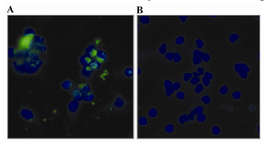 Figure 6. Immunofluorescent staining of M.genitalium in-fected PBMC using purified anti-P110 antibody. PBMC from a human healthy individual was infected with M.genitalium and the presence of organism in infected cells was monitored by indirect immunofluorescent staining using polyclonal anti-P110 antibody 3 hr after infection. DAPI was used for staining the nucleus (blue). The green speckled fluorescence signal shows the presence of M.genitalium in infected PBMC (A); Uninfected PBMC served as negative control (B)

