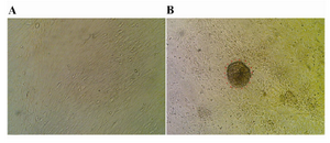 Figure 1. Sertoli and spermatogonial cells: A) Monolayer of bovine Sertoli cell; B) Spermatogonial-derived colony on a monolayer of Sertoli cell; ×200