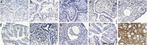 Figure 3. Immunohistochemical analysis of reproductive organs of cycling mice with antiTG antibody Uterus, ovary and fallopian tubes of cycling Balb/C mice were tested by immunohistochemistry for expression of TG. TG was not expressed in any of the tissues at all stages of estrous cycle. a-d: endometrium in proestrous, estrus, metestrous and diestrous, respectively. e and f: representative of ovary and fallopian tube. g-i: negative controls of endometrium, ovary and fallopian tubes. j: thyroid as positive control. 