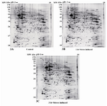 Figure 3. A representative image of silver nitrate-stained 2DE gel from control (A), 1 hr (B), and 3 hr (C) stress-induced hippocampus rats. Proteins were separated on a pH 3-10 NL IPG strips in the first dimension and on 12% SDS polyacrylamide gel in second dimension