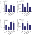 <p>Figure 1. Gene expression of <em>G6PD</em> in heart, liver, skeletal muscle, and renal tissues in four studied groups (n=10) (Control, HFD, HFD/STZ+Q, HFD/STZ+Cur). Data are expressed as mean&plusmn;SD.</p>
<p>* p-value &lt;0.05 compared with the control group, # p-value &lt;0.05 compared with the HFD group. HFD: High fat diet, STZ: Streptozotocin, Cur: Curcumin.</p>
