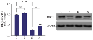 <p>Figure 3. The effect of swimming on the expression of DRP1 in the heart of rats treated with Doxorubicin. The results are reported as mean&plusmn;standard deviation. GAPDH protein was used as a calibrator. All assays were performed in triplicates. ** and **** indicate the significant statistical difference between different experimental groups at p&lt;0.01 and p&lt;0.0001, respectively. (C (control group), S (swimming group), D (DOX group), DS (swimming + DOX group).</p>

