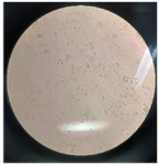 <p>Figure 2. The image prepared from synovial fluid sample taken from newly diagnosed patients with rheumatoid arthritis. Leukocytes in a synovial fluid sample under Neubauer slide (Hemocytometer; <em>mm<sup>3</sup></em>).</p>