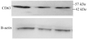 <p>Figure 2. Western blot analysis of exosomes derived from luteolin-treated 4T1 cells. CD63 expression was detected, with &beta;-actin serving as the loading control.</p>
