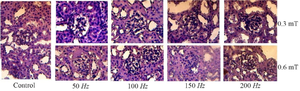 <p>Figure 8. Histology of mice kidneys exposed to magnetic fields at frequencies of 50-200 <em>Hz</em>.</p>