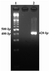 Figure 1. Mtb32C PCR result. Lane 1 is 100 bp DNA size marker and lane 2 is Mtb32C PCR product (420 bp fragment)