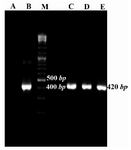 Figure 2. Colony-PCR results for growing colonies using Mtb32C specific primers. Lane A: negative control of PCR (PCR mixture was prepared using water instead of DNA template), B: positive control (purified PCR product from Agarose gel), C, D, and E: positive colonies containing recombinant vector consist of Mtb32C fragment (420 bp fragment), M: 100 bp DNA size marker