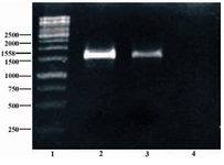 Figure 3. Colony PCR was done using specific primers of pET-32 Ek-LIC vector, followed by 1.5% agarose gel electrophoresis. Lane 1 shows 1 kb size marker (Fermentas, Vinius, Lithuania); Lane 2 shows synthesized sequence as positive control; Lane 3 shows colony PCR product; Lane 4 represents negative control